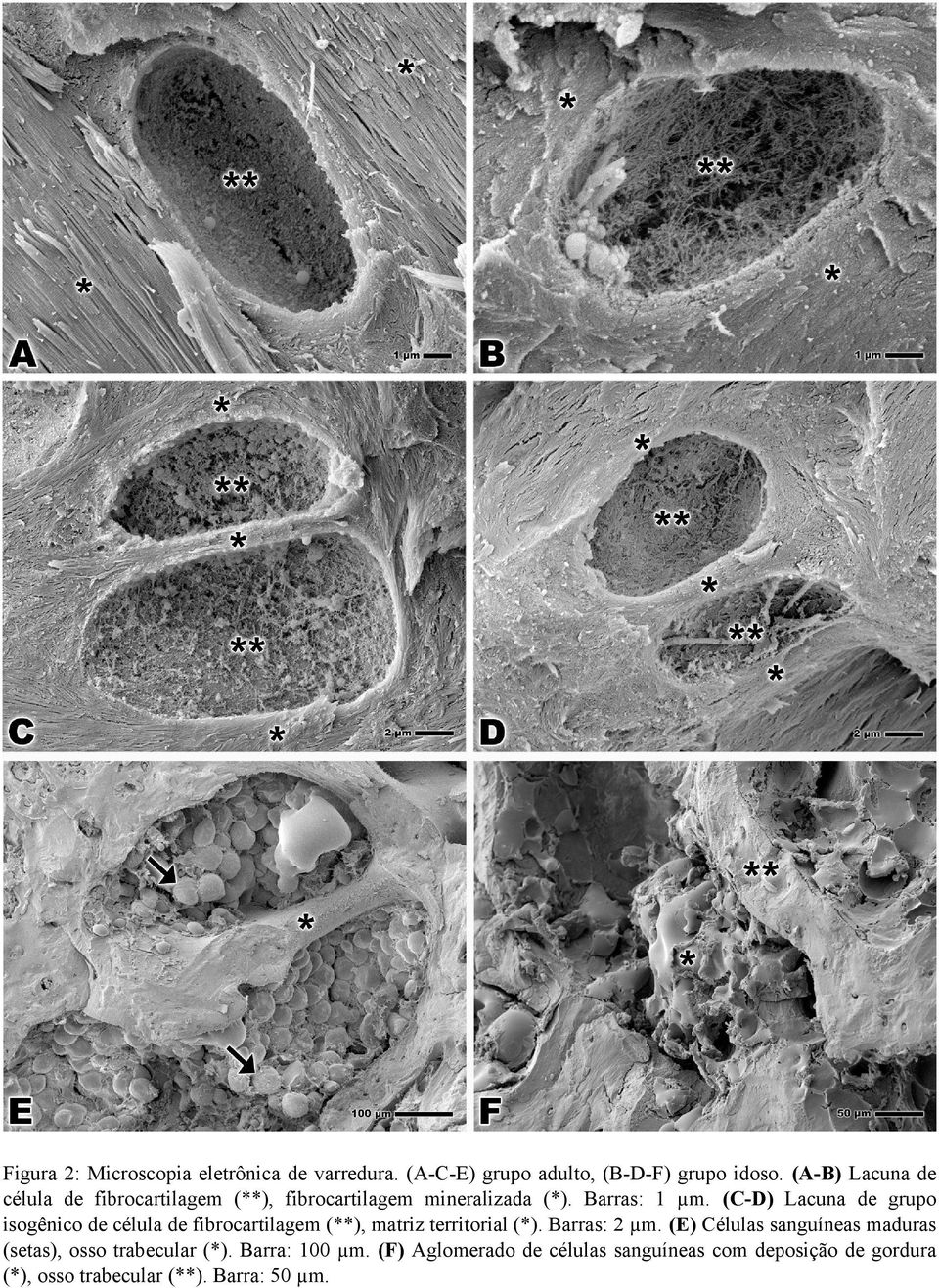 (C-D) Lacuna de grupo isogênico de célula de fibrocartilagem (**), matriz territorial (*). Barras: 2 µm.