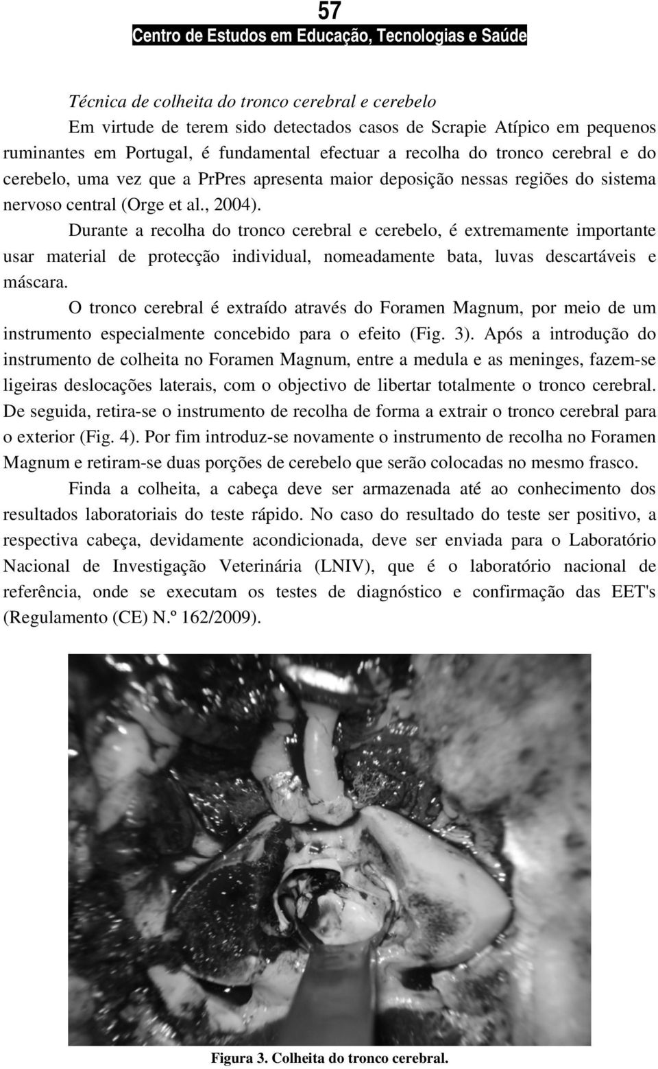 Durante a recolha do tronco cerebral e cerebelo, é extremamente importante usar material de protecção individual, nomeadamente bata, luvas descartáveis e máscara.