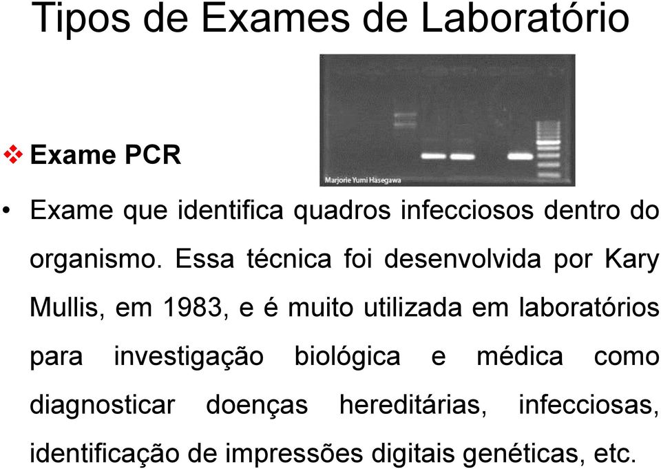 Essa técnica foi desenvolvida por Kary Mullis, em 1983, e é muito utilizada em