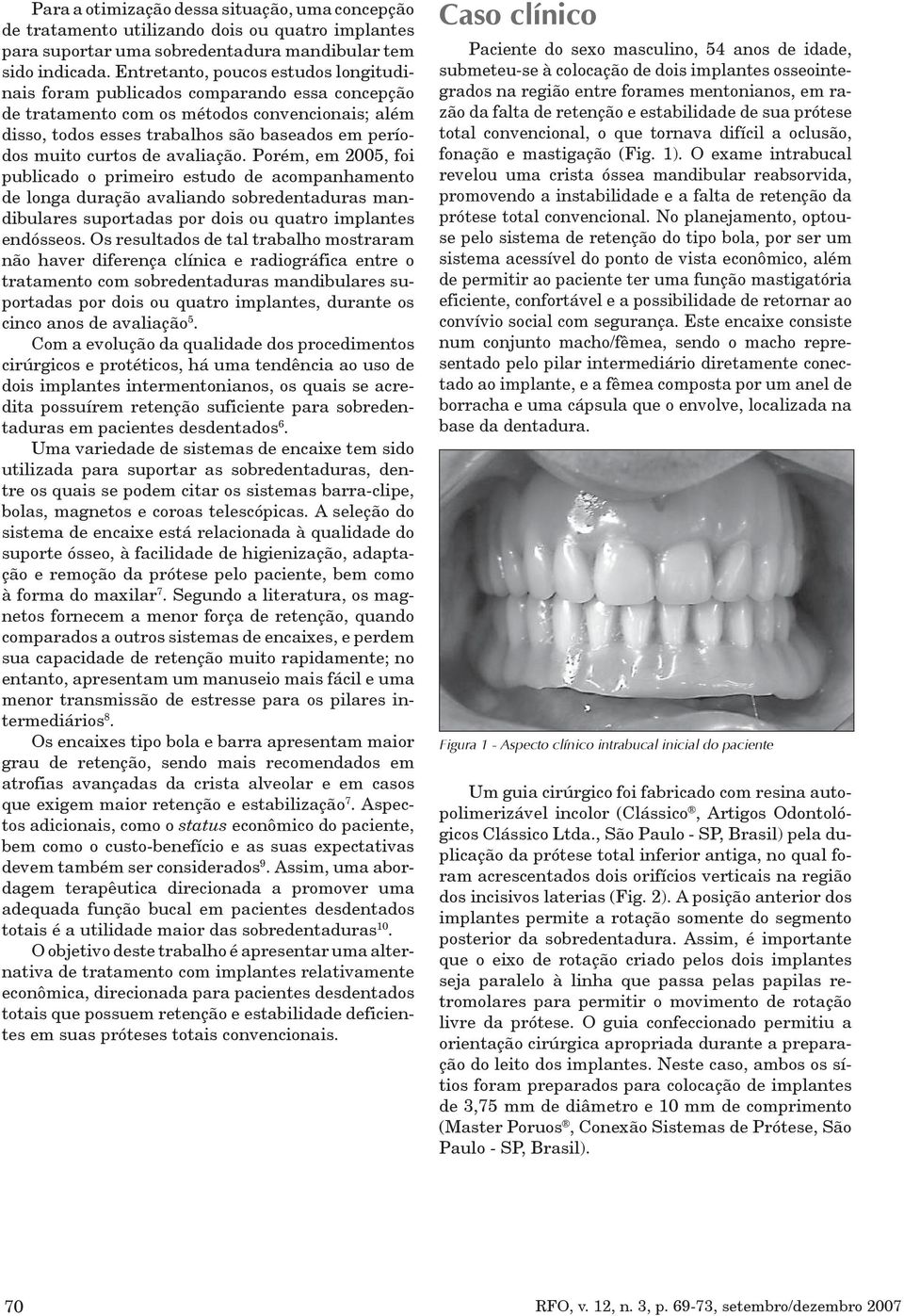 de avaliação. Porém, em 2005, foi publicado o primeiro estudo de acompanhamento de longa duração avaliando sobredentaduras mandibulares suportadas por dois ou quatro implantes endósseos.