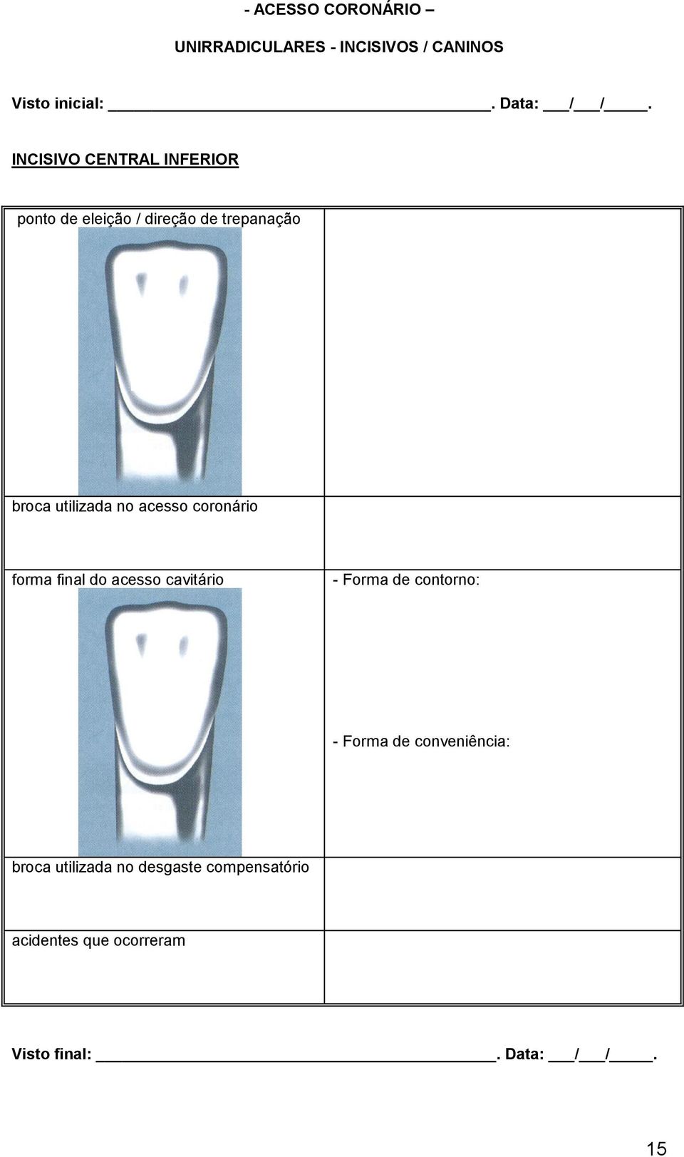 acesso coronário forma final do acesso cavitário - Forma de contorno: - Forma de