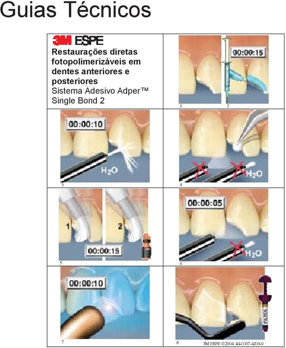 dentes anteriores e posteriores