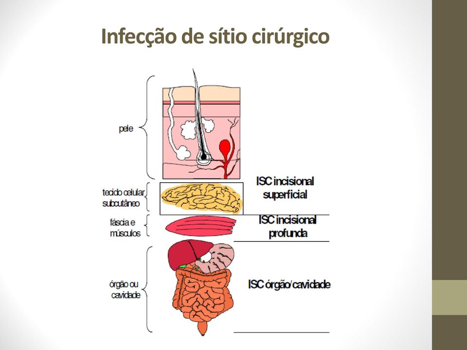 cirúrgico