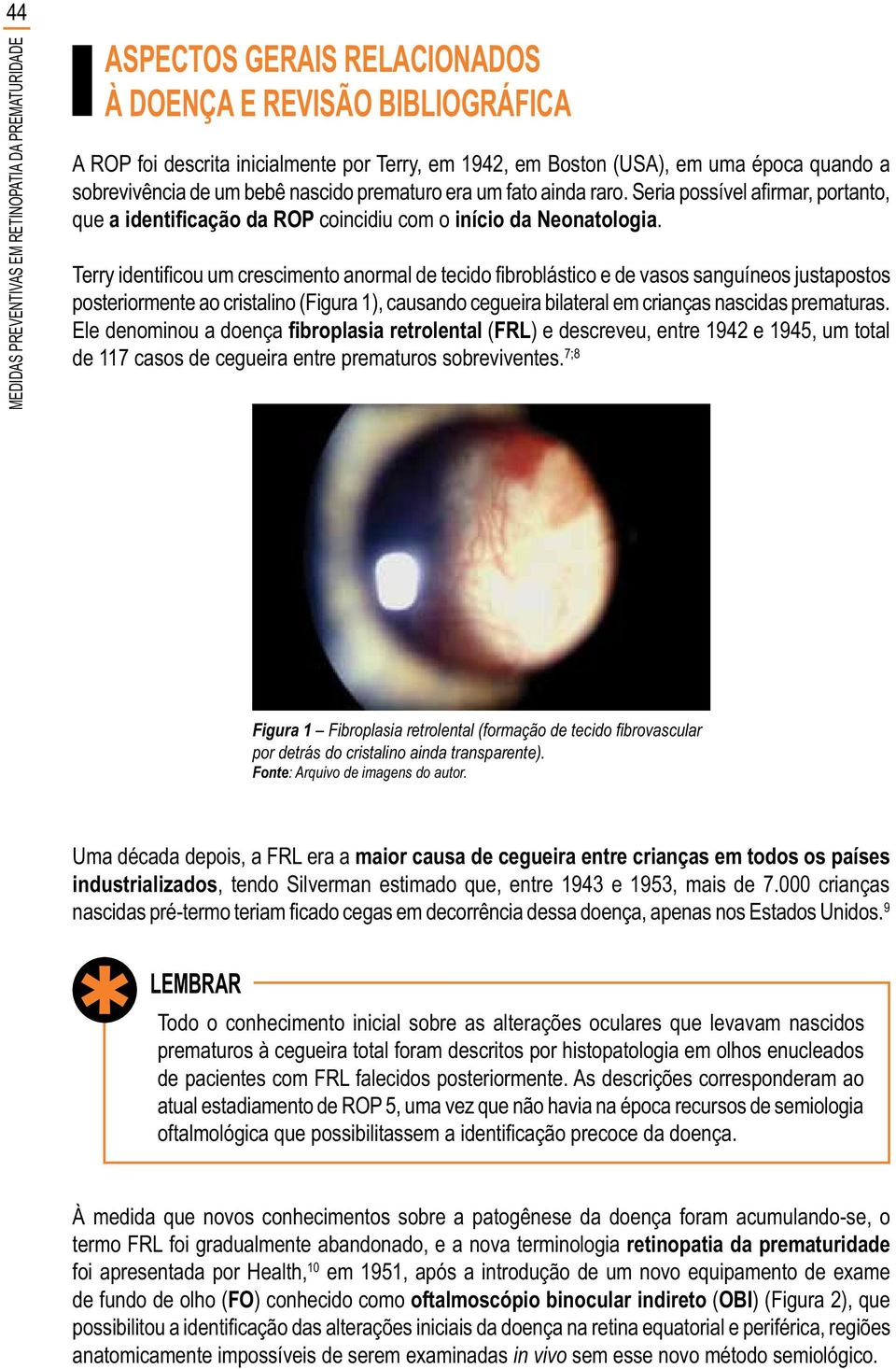 Ele denominou a doença (FRL) e descreveu, entre 1942 e 1945, um total de 117 casos de cegueira entre prematuros sobreviventes. 7;8 Figura 1 por detrás do cristalino ainda transparente).