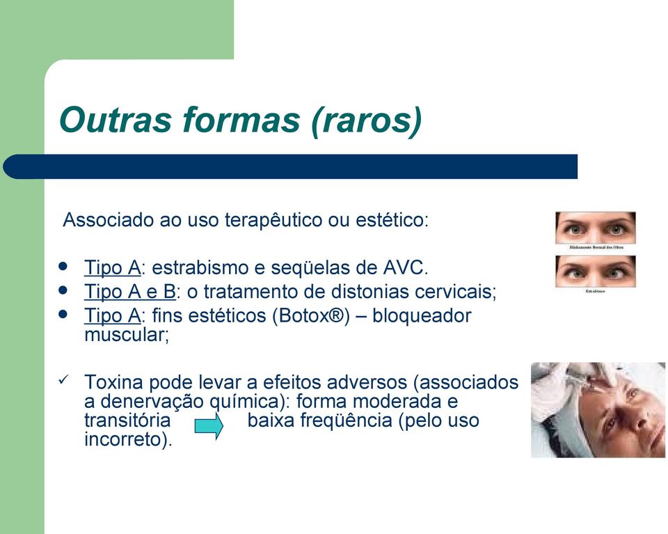 Tipo A e B: o tratamento de distonias cervicais; Tipo A: fins estéticos (Botox )