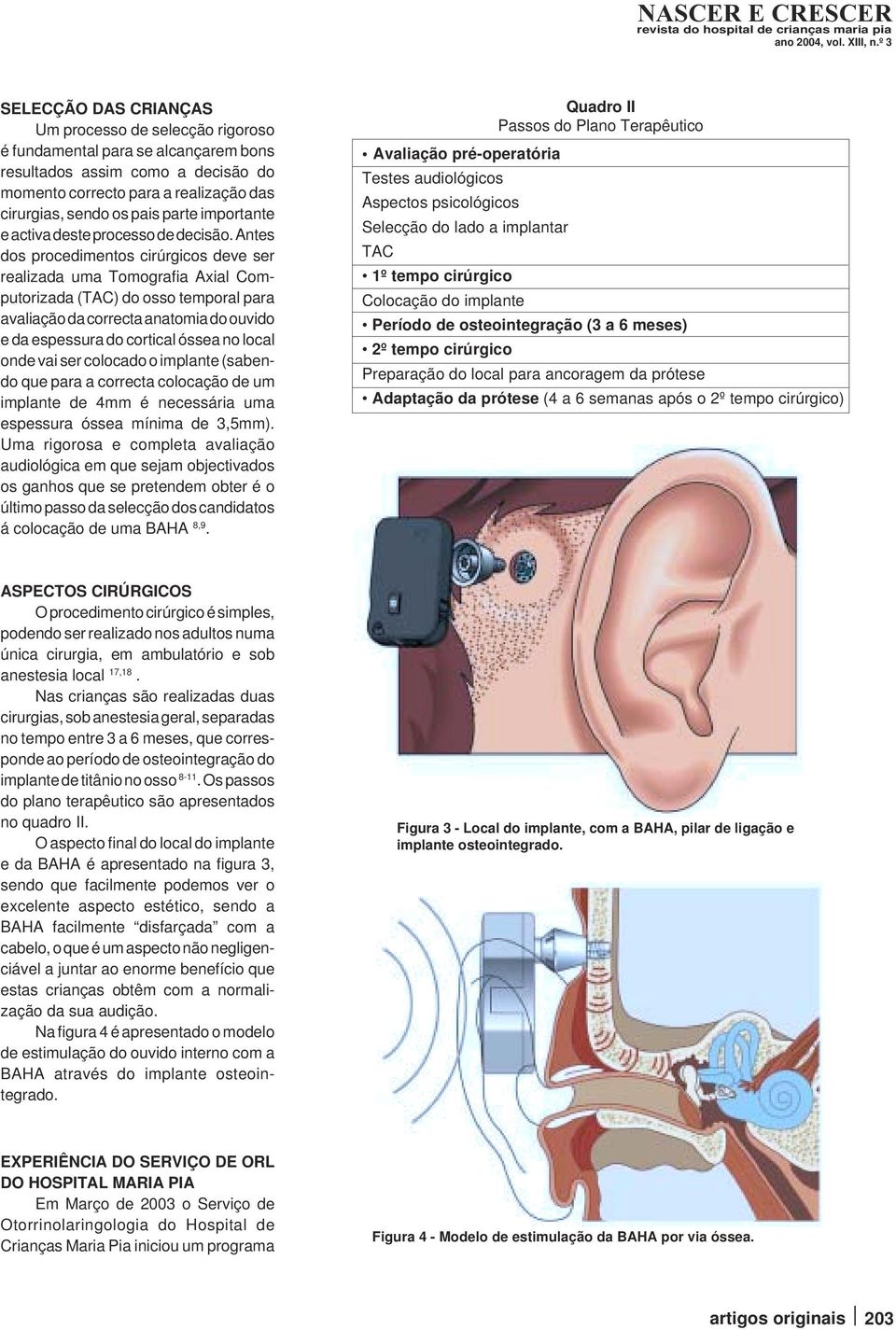 Antes dos procedimentos cirúrgicos deve ser realizada uma Tomografia Axial Computorizada (TAC) do osso temporal para avaliação da correcta anatomia do ouvido e da espessura do cortical óssea no local