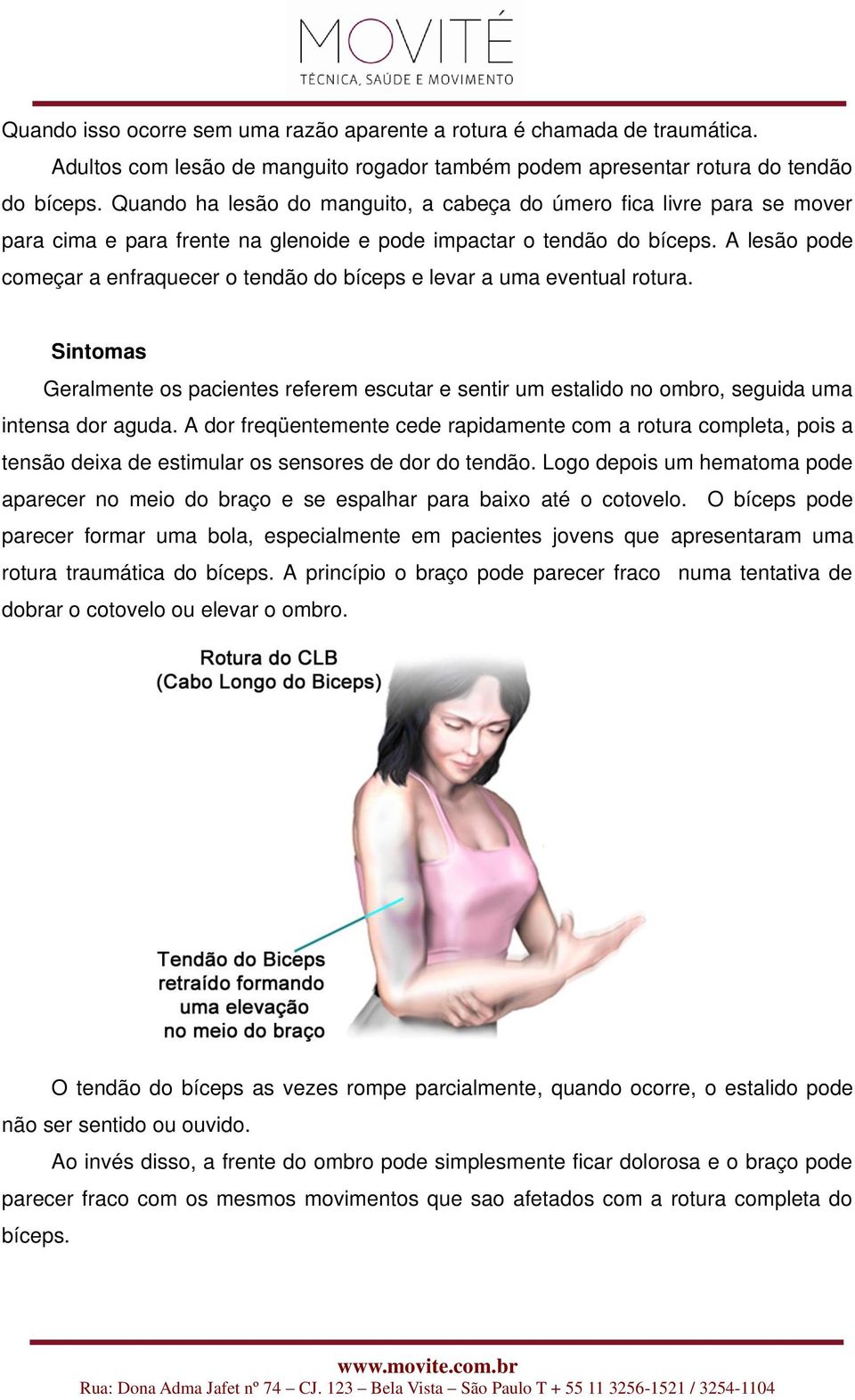 A lesão pode começar a enfraquecer o tendão do bíceps e levar a uma eventual rotura. Sintomas Geralmente os pacientes referem escutar e sentir um estalido no ombro, seguida uma intensa dor aguda.