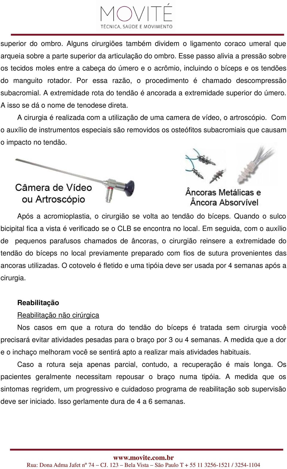 Por essa razão, o procedimento é chamado descompressão subacromial. A extremidade rota do tendão é ancorada a extremidade superior do úmero. A isso se dá o nome de tenodese direta.