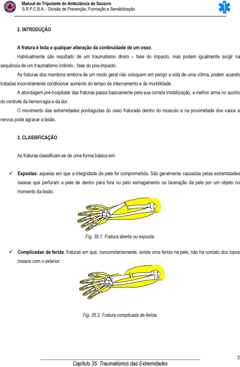 As fraturas dos membros embora de um modo geral não coloquem em perigo a vida de uma vítima, podem quando tratadas incorretamente condicionar aumento do tempo de internamento e de morbilidade.