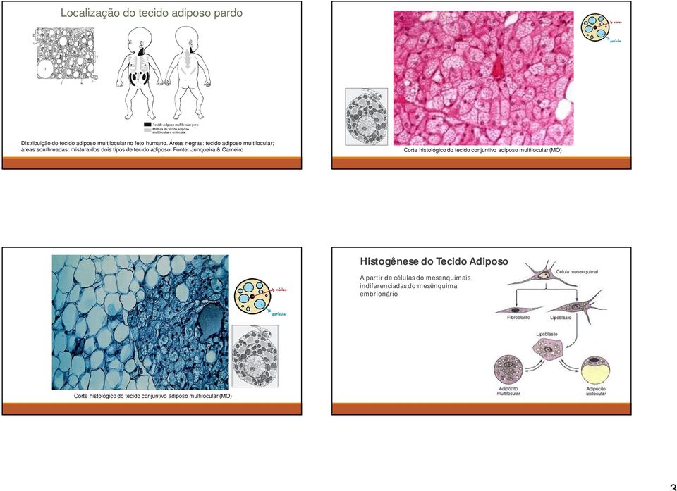 Fonte: Junqueira & Carneiro Corte histológico do tecido conjuntivo adiposo multilocular (MO) Histogênese do Tecido