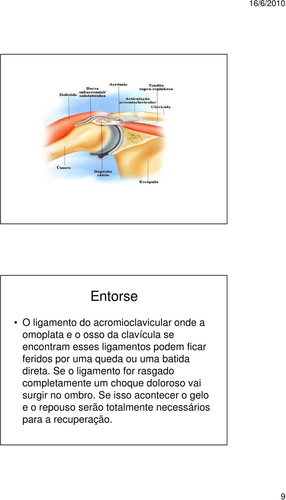 Se o ligamento for rasgado completamente um choque doloroso vai surgir no ombro.