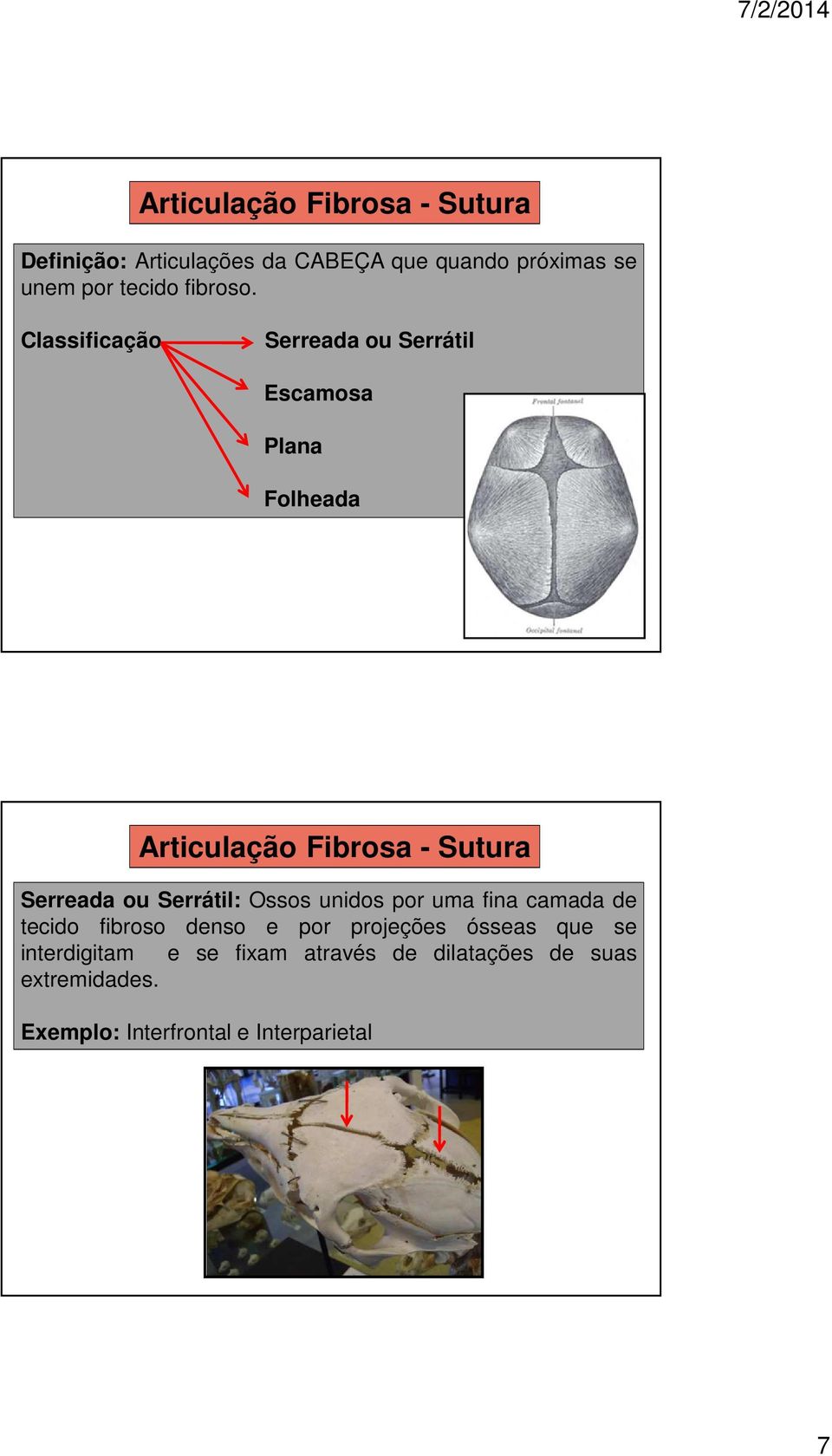 Classificação Serreada ou Serrátil Escamosa Plana Folheada Articulação Fibrosa - Sutura Serreada ou