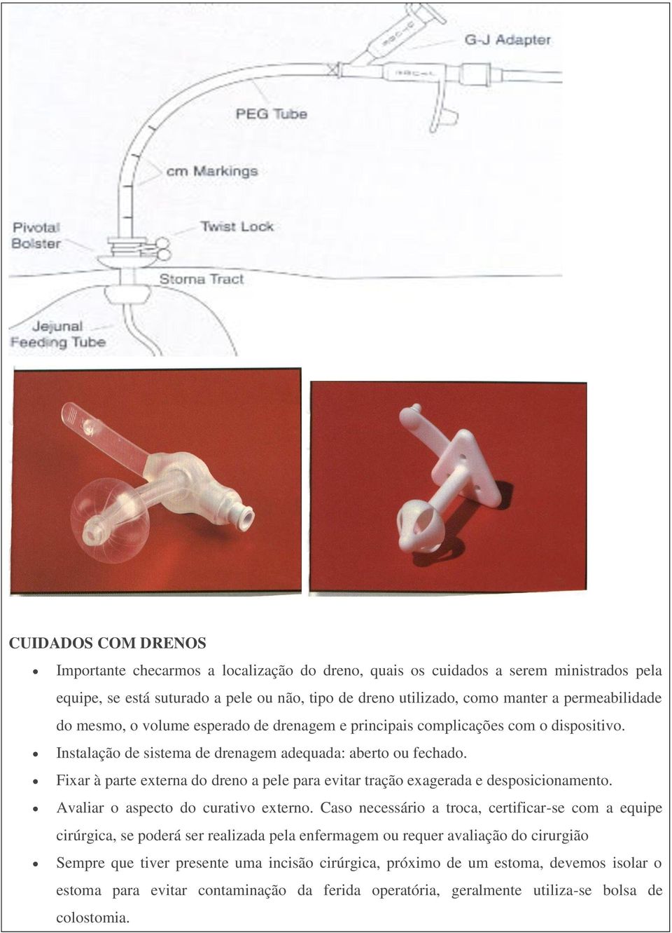 Fixar à parte externa do dreno a pele para evitar tração exagerada e desposicionamento. Avaliar o aspecto do curativo externo.