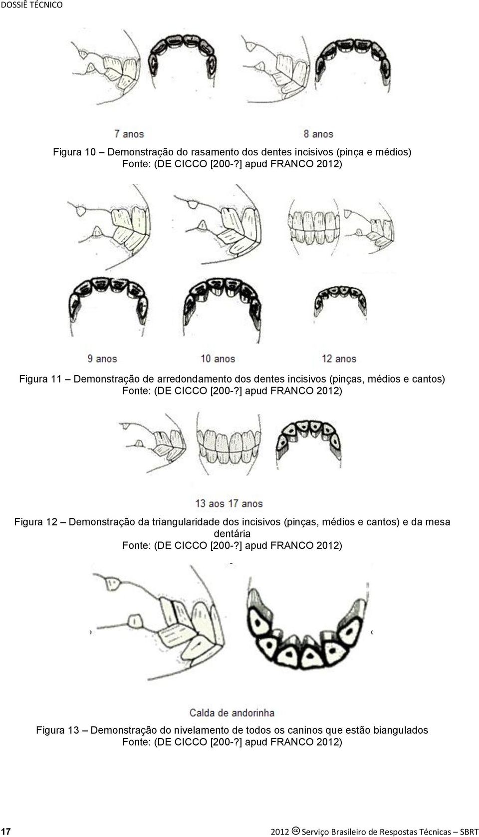 ] apud FRANCO 2012) Figura 12 Demonstração da triangularidade dos incisivos (pinças, médios e cantos) e da mesa dentária Fonte: (DE CICCO [200-?