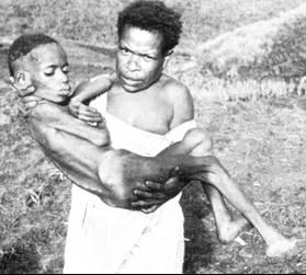 Richtzenhain VPS/FMVZ/USP Daniel Carleton Gajdusek Nobel de Medicina 1976 ENCEFALOPATIAS ESPONGIFORMES TRANSMISSÍVEIS Geral Kuru Papua Nova Guiné 1957 Período de incubação prolongado (meses/anos)