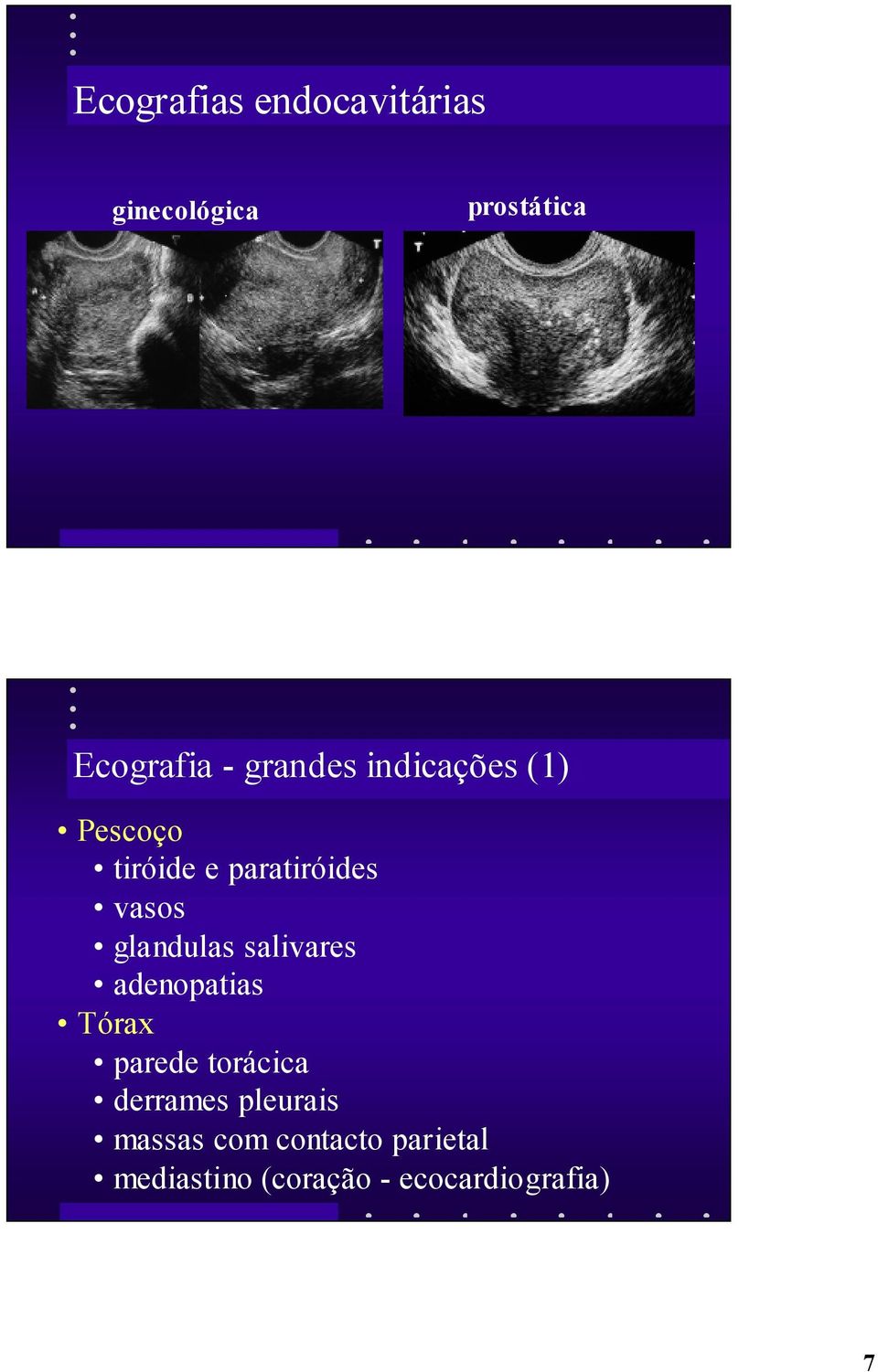 glandulas salivares adenopatias Tórax parede torácica derrames