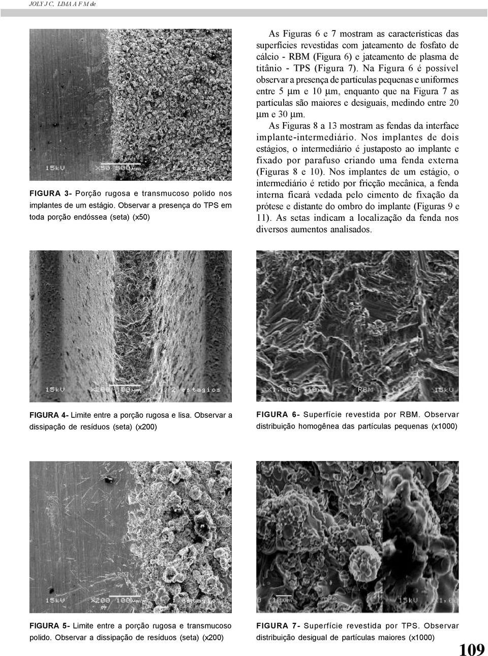 jateamento de plasma de titânio - TPS (Figura 7).