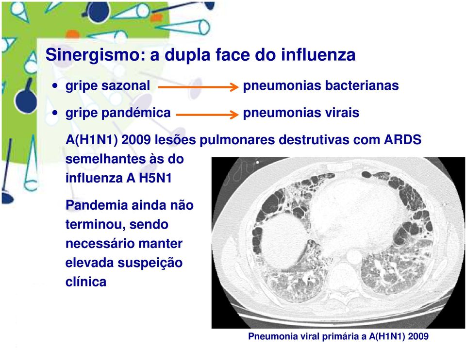 ARDS semelhantes às do influenza A H5N1 Pandemia ainda não terminou, sendo