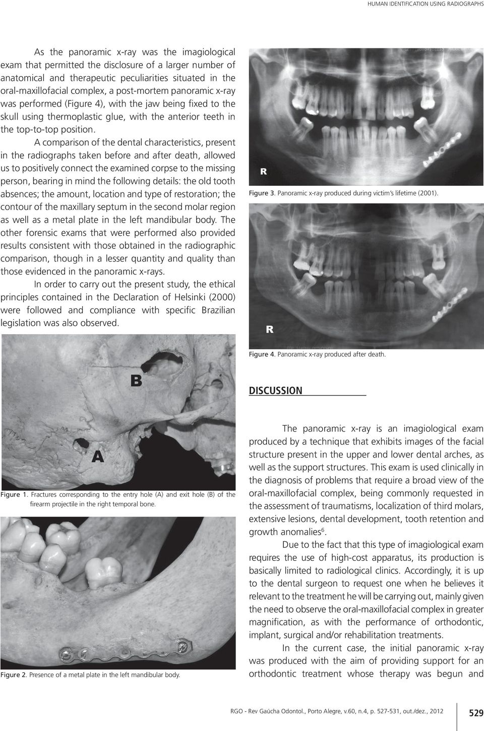 A comparison of the dental characteristics, present in the radiographs taken before and after death, allowed us to positively connect the examined corpse to the missing person, bearing in mind the