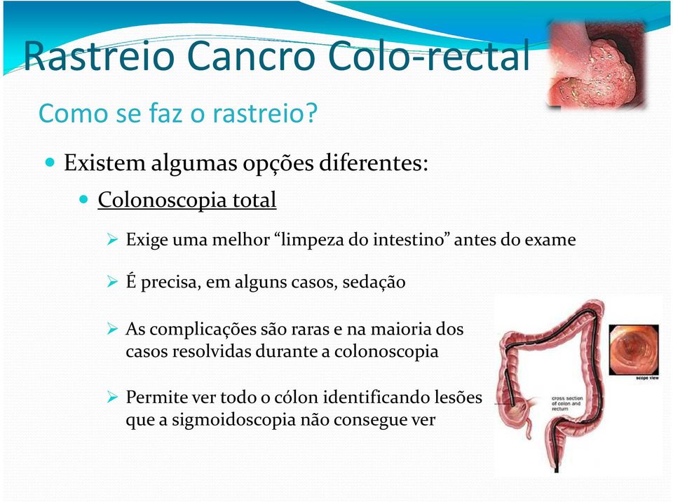 intestino antes do exame É precisa, em alguns casos, sedação As complicações são