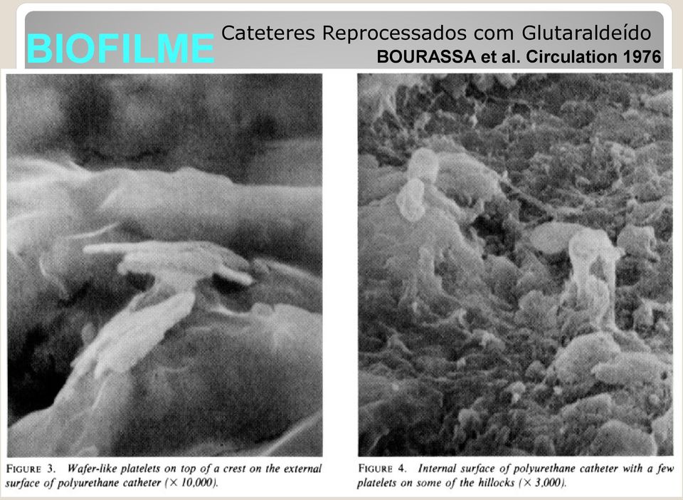 Glutaraldeído