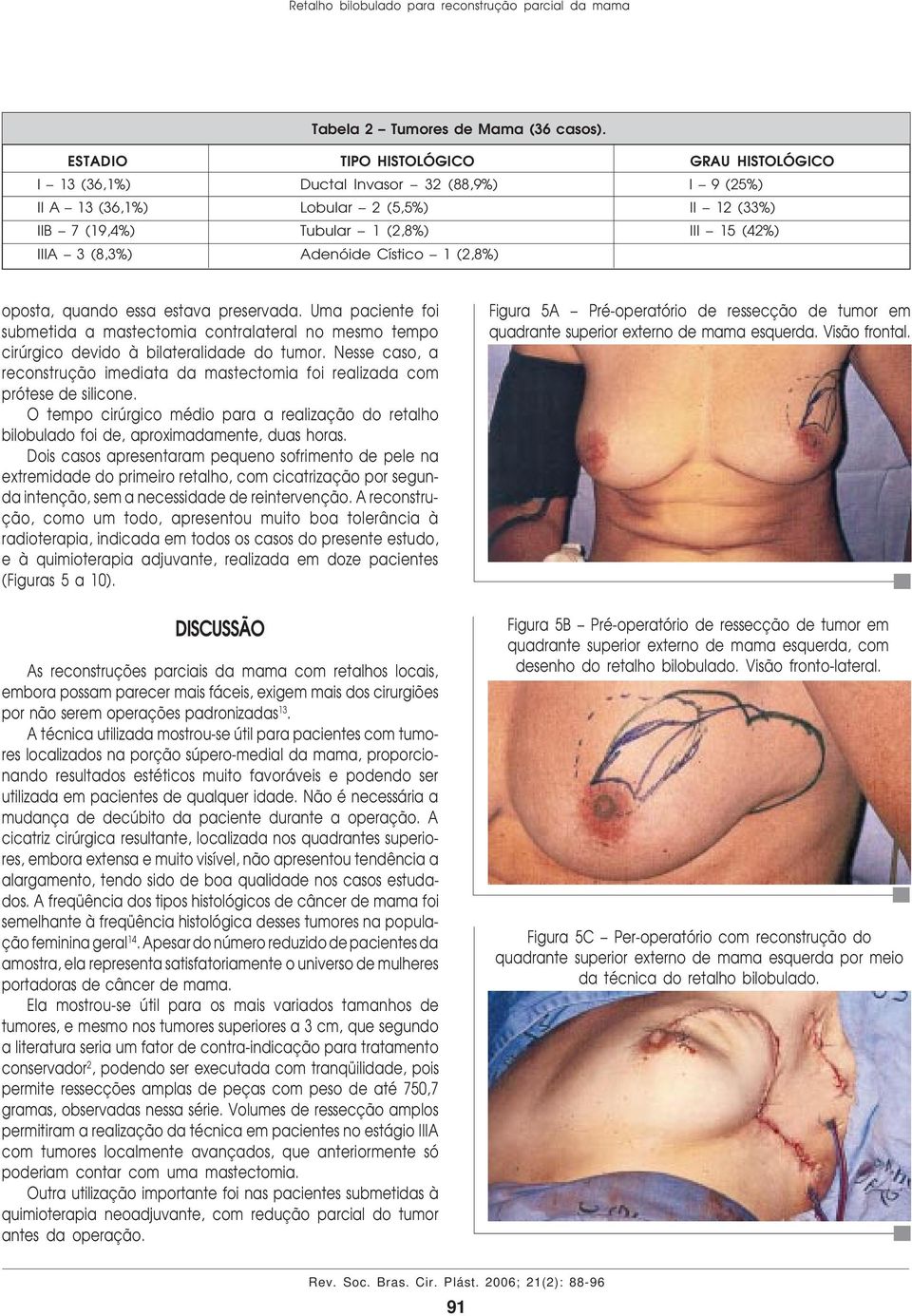 Adenóide Cístico 1 (2,8%) oposta, quando essa estava preservada. Uma paciente foi submetida a mastectomia contralateral no mesmo tempo cirúrgico devido à bilateralidade do tumor.