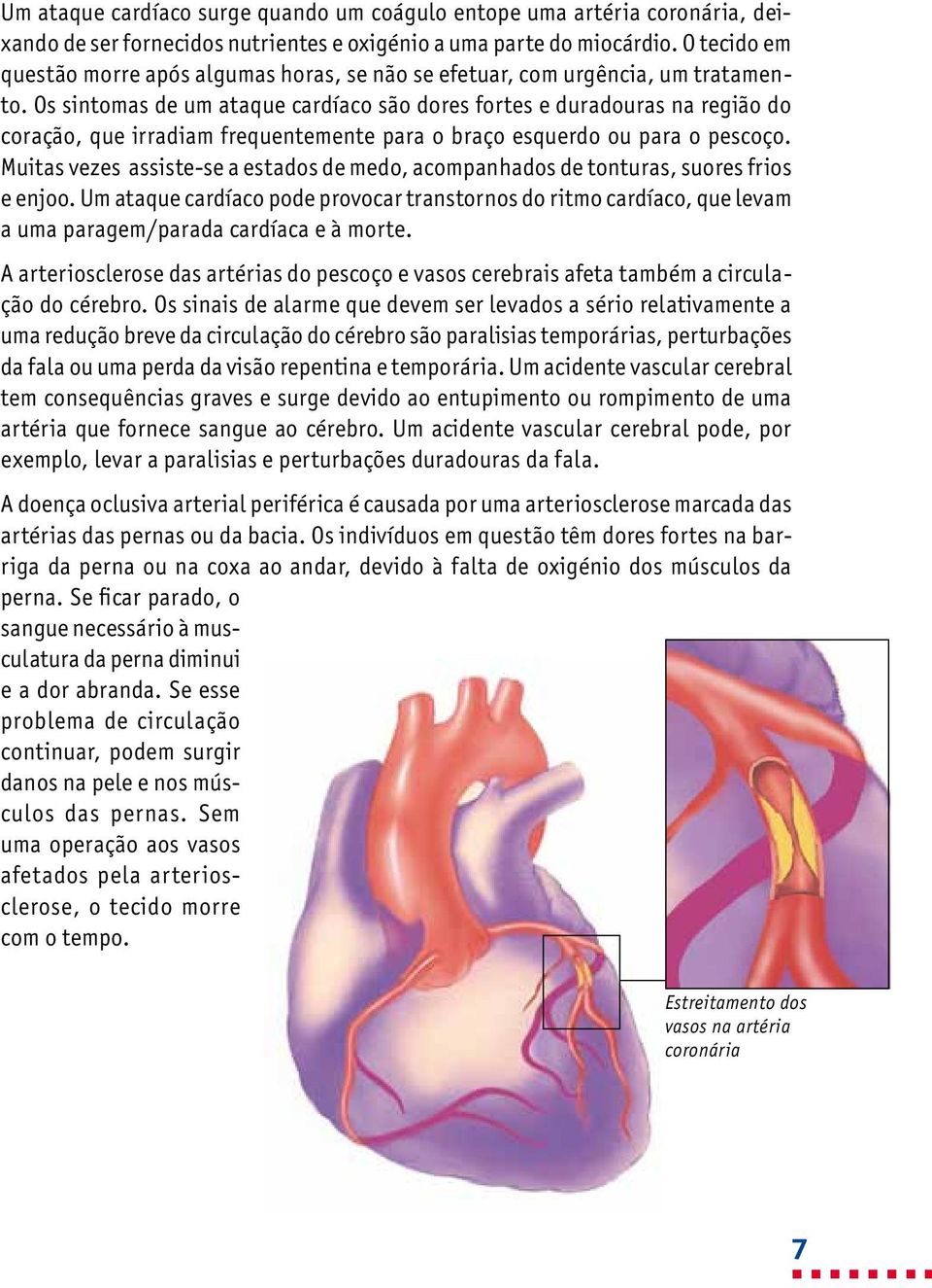 Os sintomas de um ataque cardíaco são dores fortes e duradouras na região do coração, que irradiam frequentemente para o braço esquerdo ou para o pescoço.