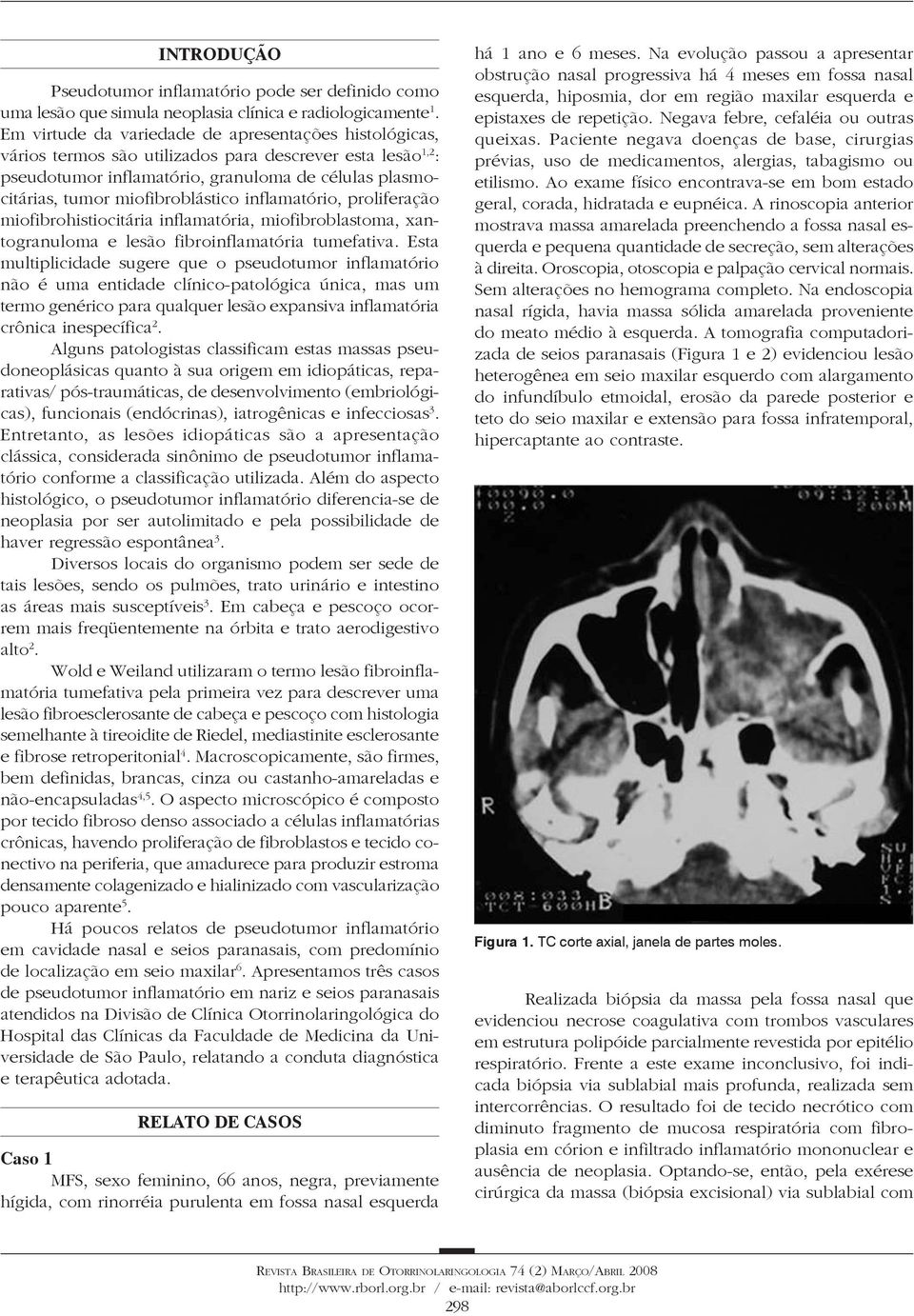 miofibroblástico inflamatório, proliferação miofibrohistiocitária inflamatória, miofibroblastoma, xantogranuloma e lesão fibroinflamatória tumefativa.