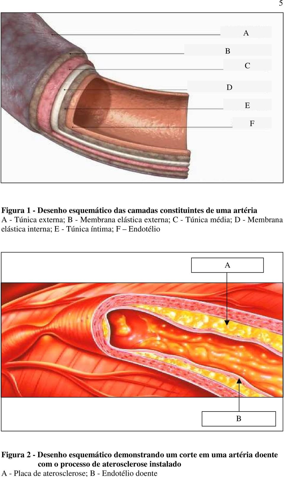 Túnica íntima; F Endotélio A B Figura 2 - Desenho esquemático demonstrando um corte em uma