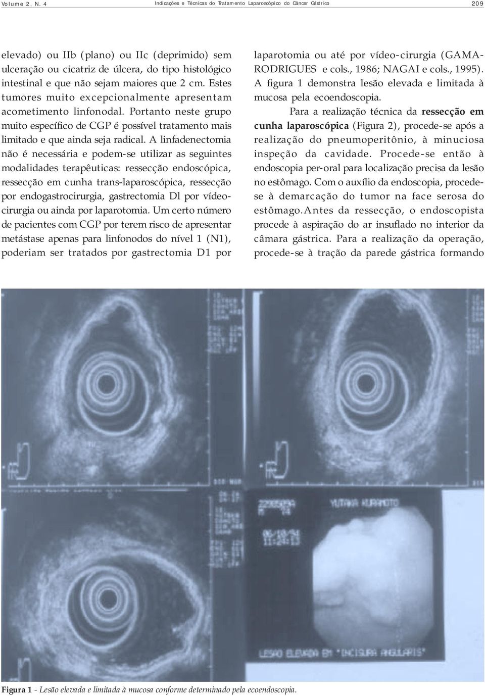 sejam maiores que 2 cm. Estes tumores muito excepcionalmente apresentam acometimento linfonodal.