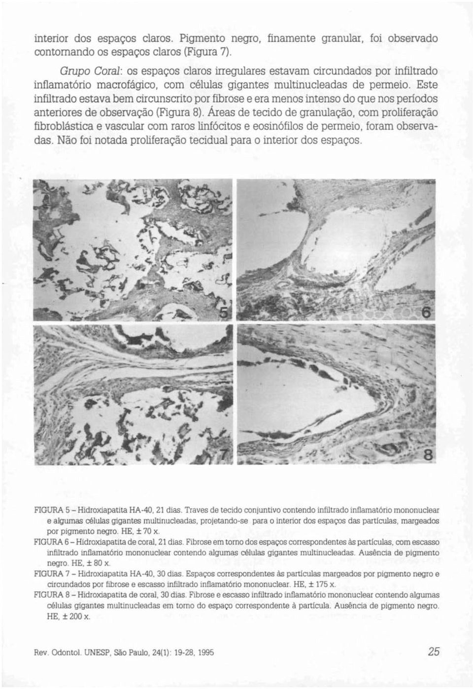 Este infiltrado estavabemcircunscritoporfibrose e eramenosintenso do que nos períodos anteriores de observação (Figura 8).