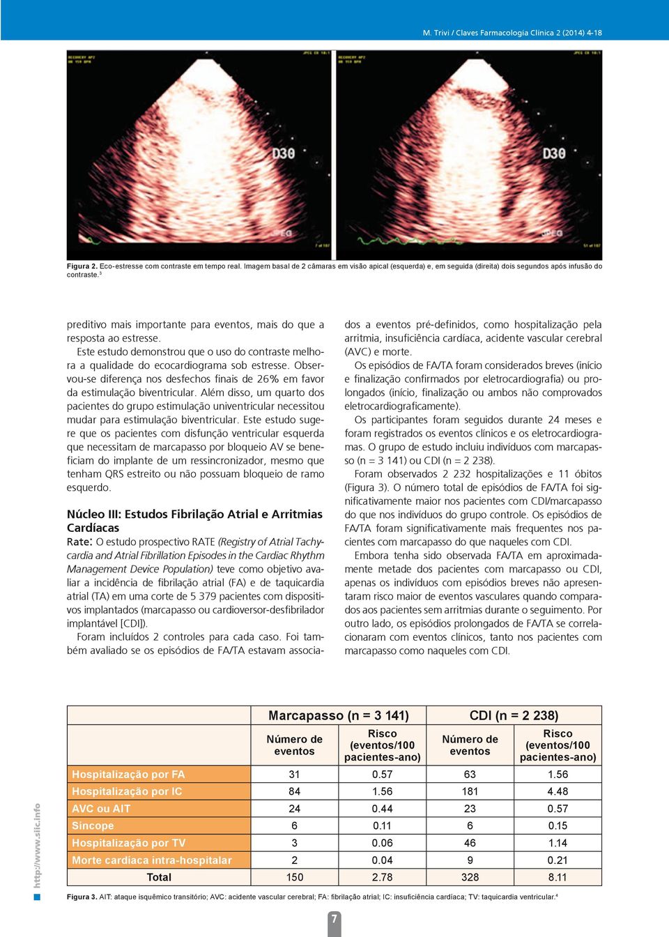 Este estudo demonstrou que o uso do contraste melhora a qualidade do ecocardiograma sob estresse. Observou-se diferença nos desfechos finais de 26% em favor da estimulação biventricular.