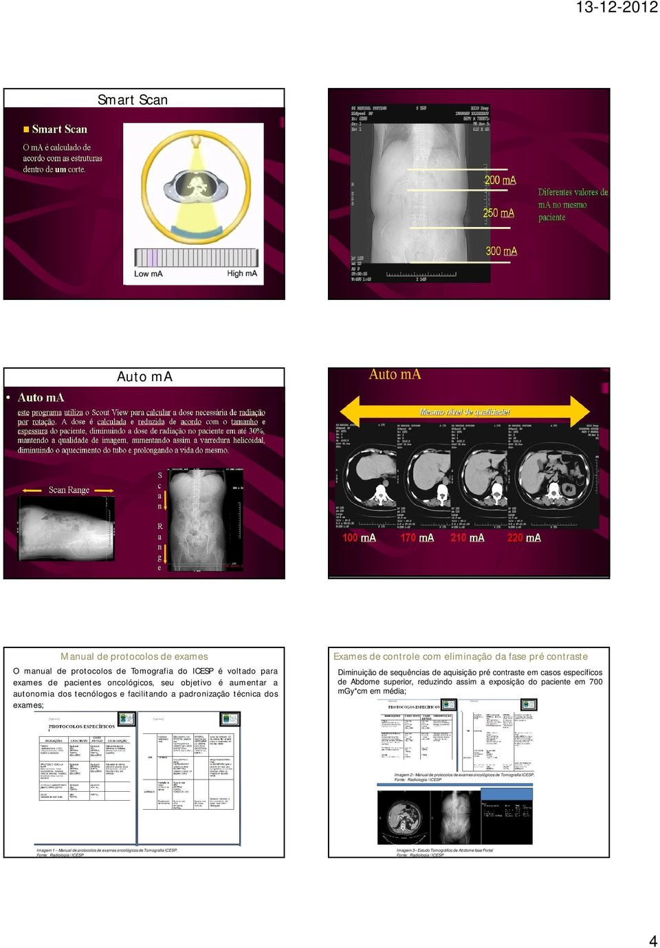 sequências de aquisição pré contraste em casos específicos de Abdome superior, reduzindo assim a exposição do paciente em 700 mgy*cm em média; Imagem 2 Manual de