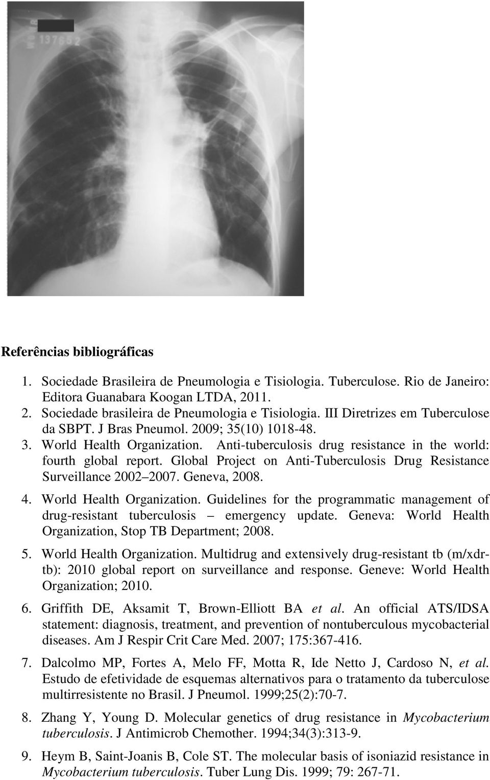 Global Project on Anti-Tuberculosis Drug Resistance Surveillance 2002 2007. Geneva, 2008. 4. World Health Organization.