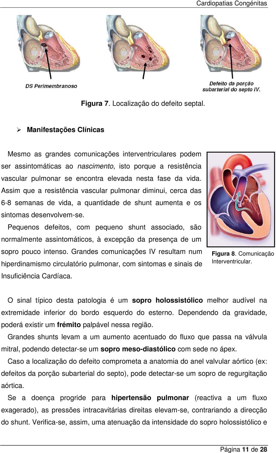 Assim que a resistência vascular pulmonar diminui, cerca das 6-8 semanas de vida, a quantidade de shunt aumenta e os sintomas desenvolvem-se.