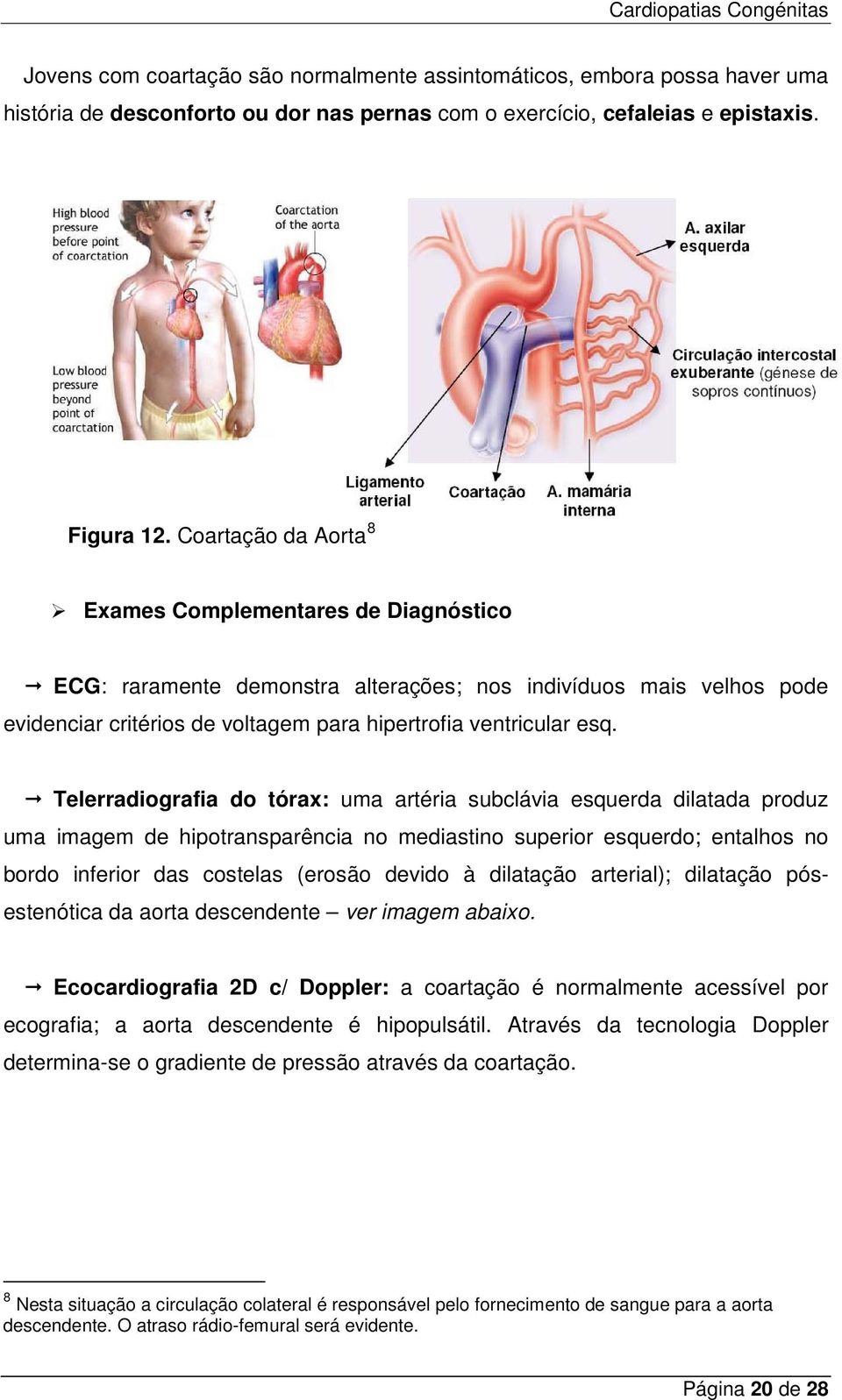 Telerradiografia do tórax: uma artéria subclávia esquerda dilatada produz uma imagem de hipotransparência no mediastino superior esquerdo; entalhos no bordo inferior das costelas (erosão devido à