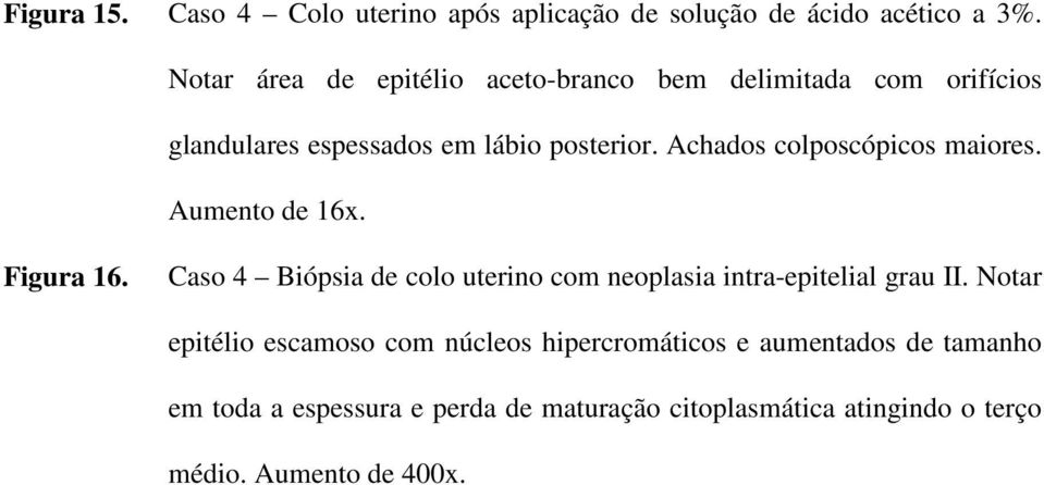 Achados colposcópicos maiores. Aumento de 16x. Figura 16.