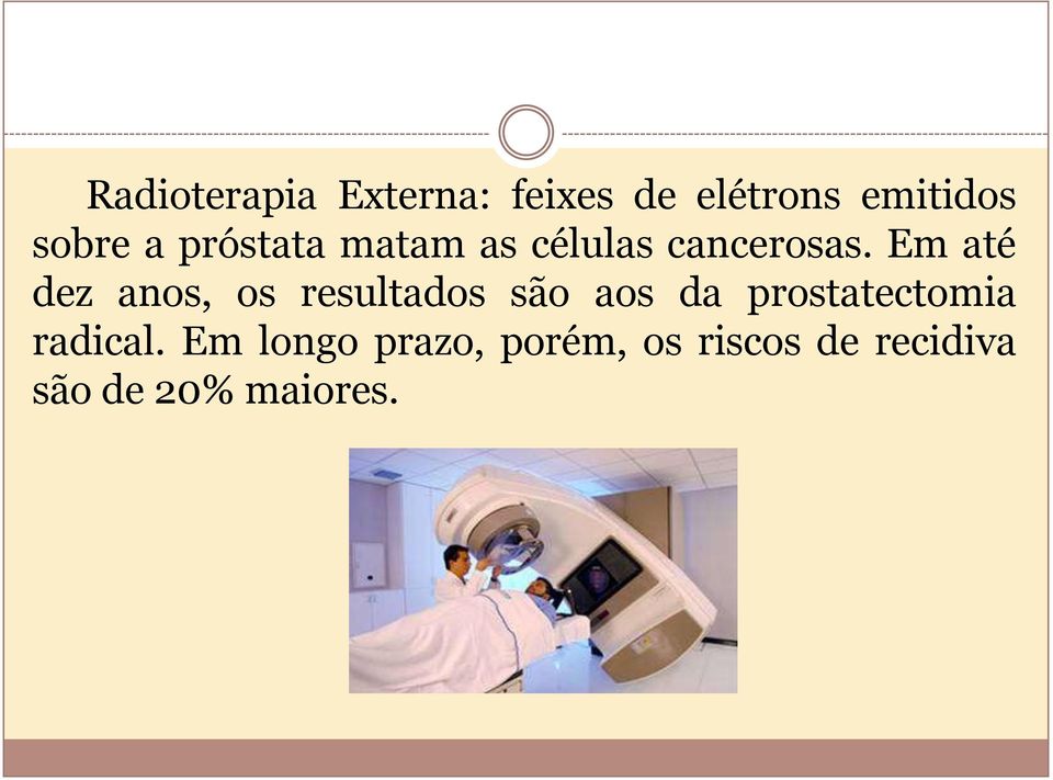 Em até dez anos, os resultados são aos da prostatectomia