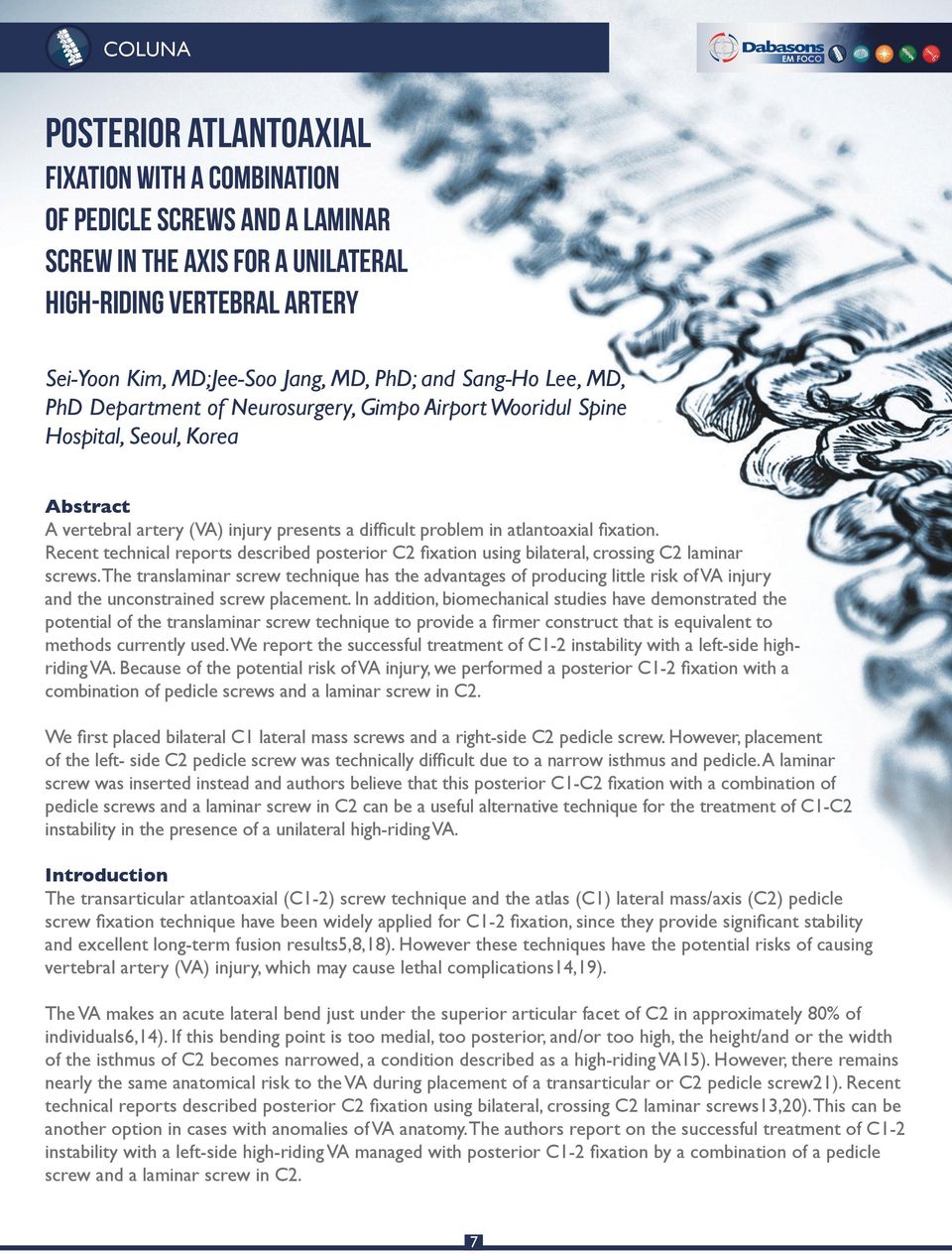 Recent technical reports described posterior C2 fixation using bilateral, crossing C2 laminar screws.