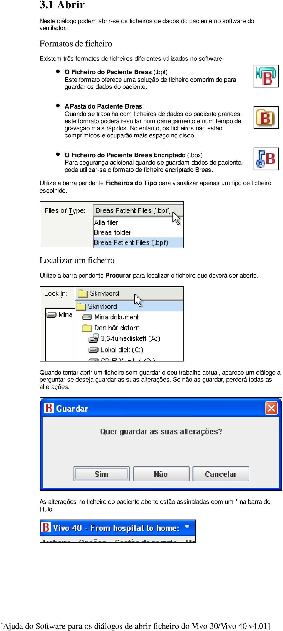 bpf) Este formato oferece uma solução de ficheiro comprimido para guardar os dados do paciente.