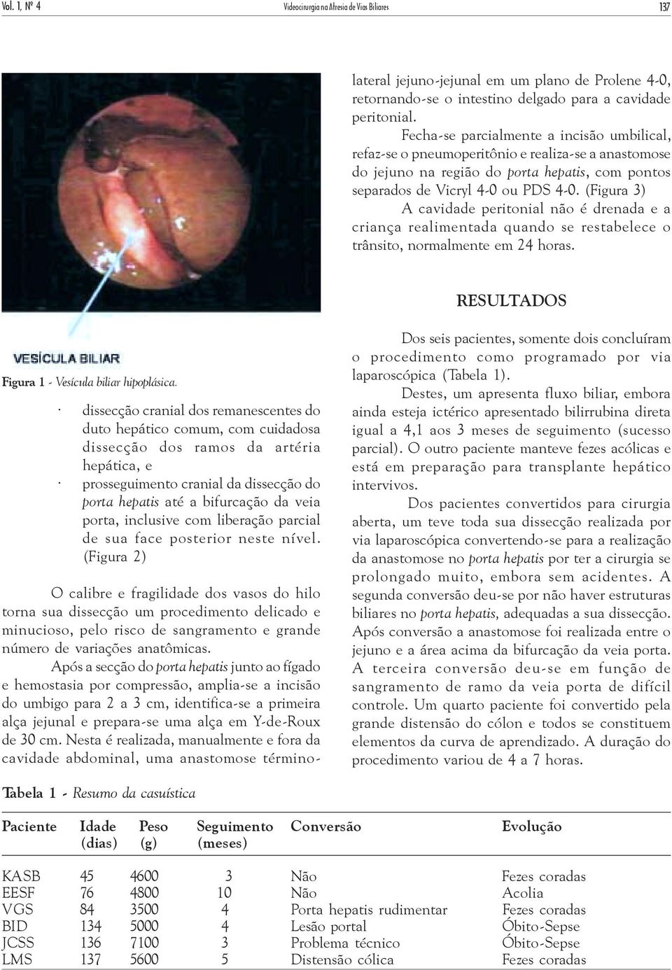 cm. Nesta é realizada, manualmente e fora da cavidade abdominal, uma anastomose términolateral jejuno-jejunal em um plano de Prolene 4-0, retornando-se o intestino delgado para a cavidade peritonial.