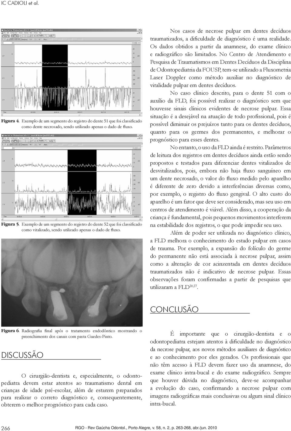 Nos casos de necrose pulpar em dentes decíduos traumatizados, a dificuldade de diagnóstico é uma realidade. Os dados obtidos a partir da anamnese, do exame clínico e radiográfico são limitados.