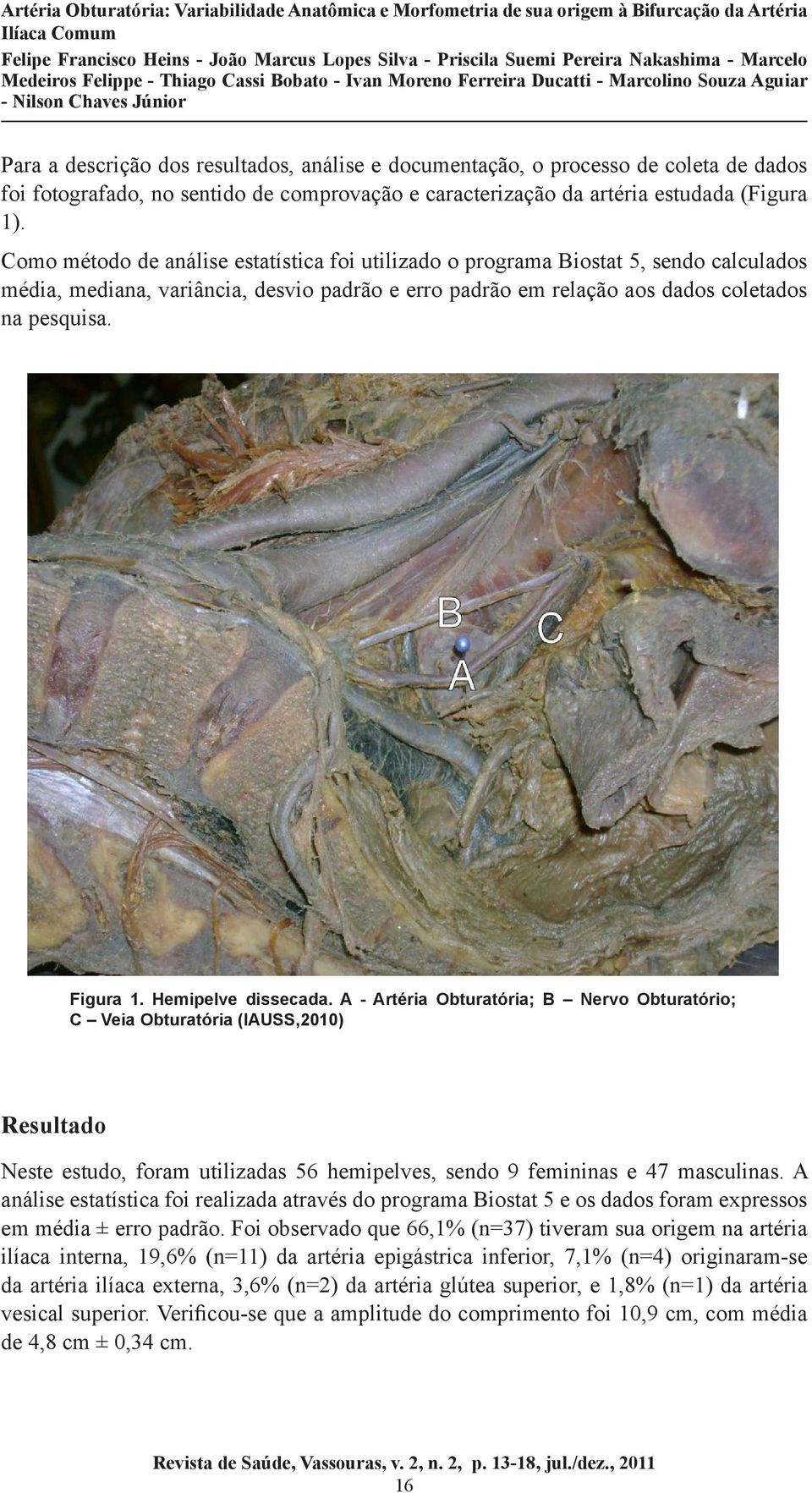 Hemipelve dissecada. A - Artéria Obturatória; B Nervo Obturatório; C Veia Obturatória (IAUSS,2010) Resultado Neste estudo, foram utilizadas 56 hemipelves, sendo 9 femininas e 47 masculinas.