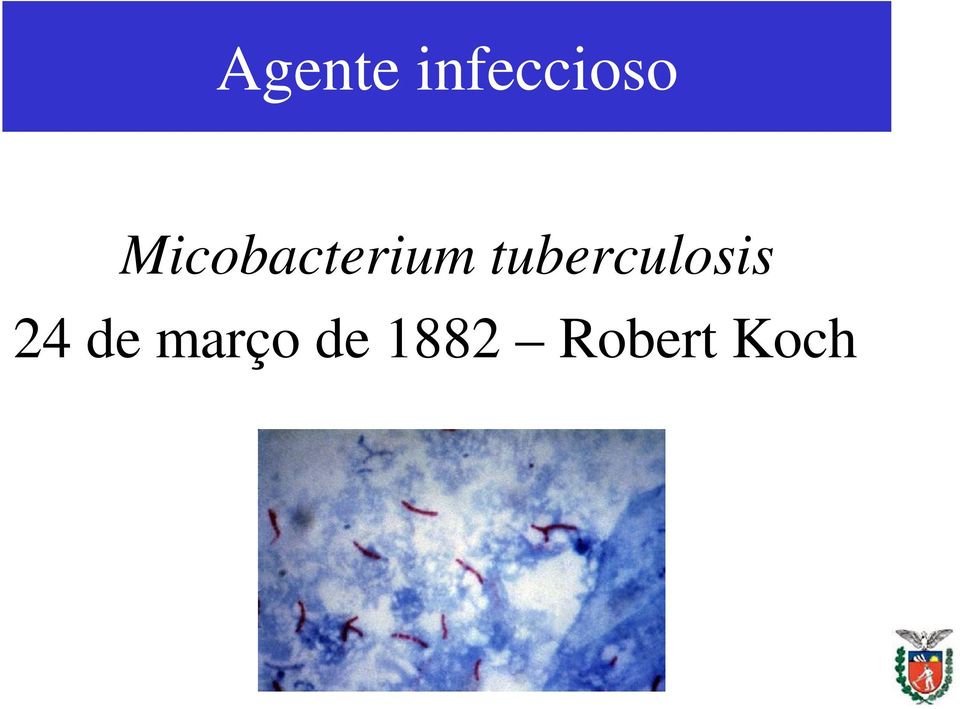 tuberculosis 24 de