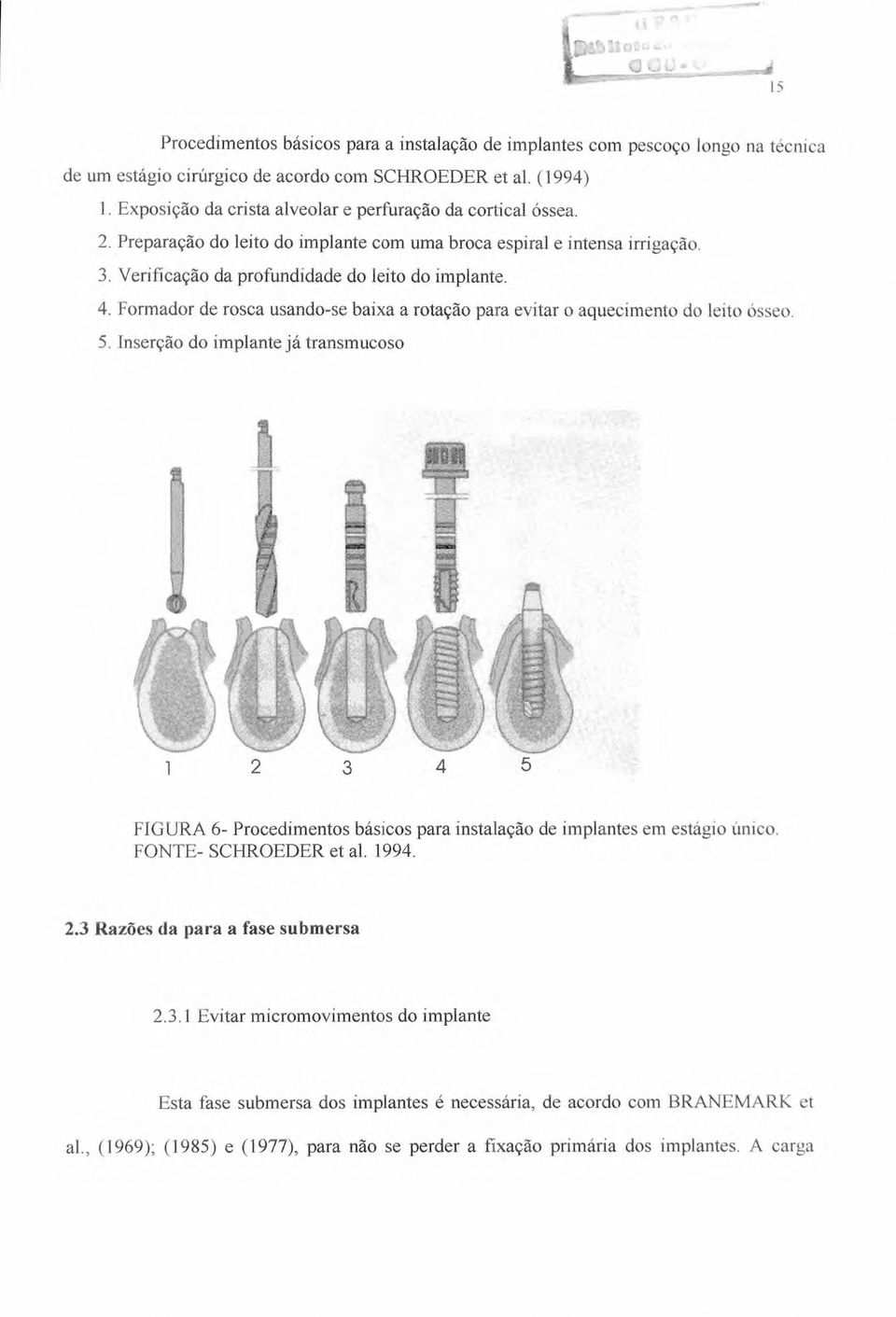 Formador de rosca usando-se baixa a rotação para evitar o aquecimento do leito ósseo. 5.