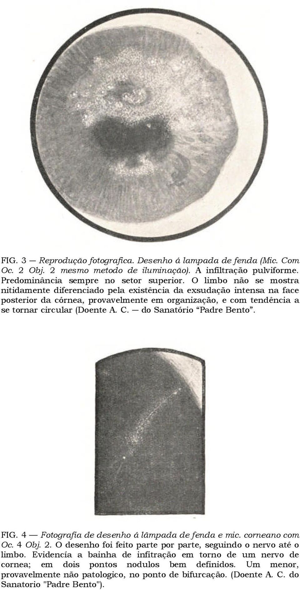 A. C. do Sanatório Padre Bento. FIG. 4 Fotografia de desenho á lâmpada de fenda e mic. corneano com Oc. 4 Obj. 2. O desenho foi feito parte por parte, seguindo o nervo até o limbo.