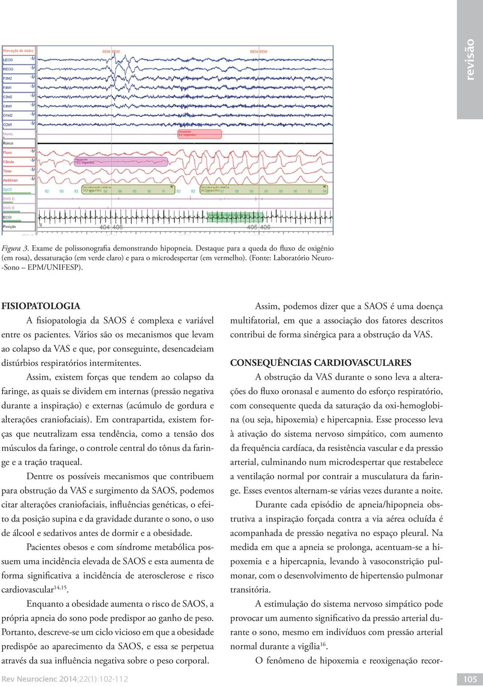 Vários são os mecanismos que levam ao colapso da VAS e que, por conseguinte, desencadeiam distúrbios respiratórios intermitentes.