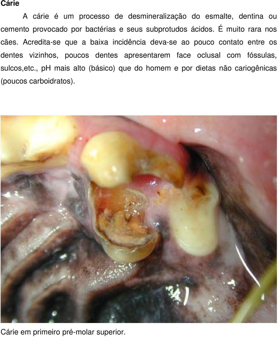 Acredita-se que a baixa incidência deva-se ao pouco contato entre os dentes vizinhos, poucos dentes