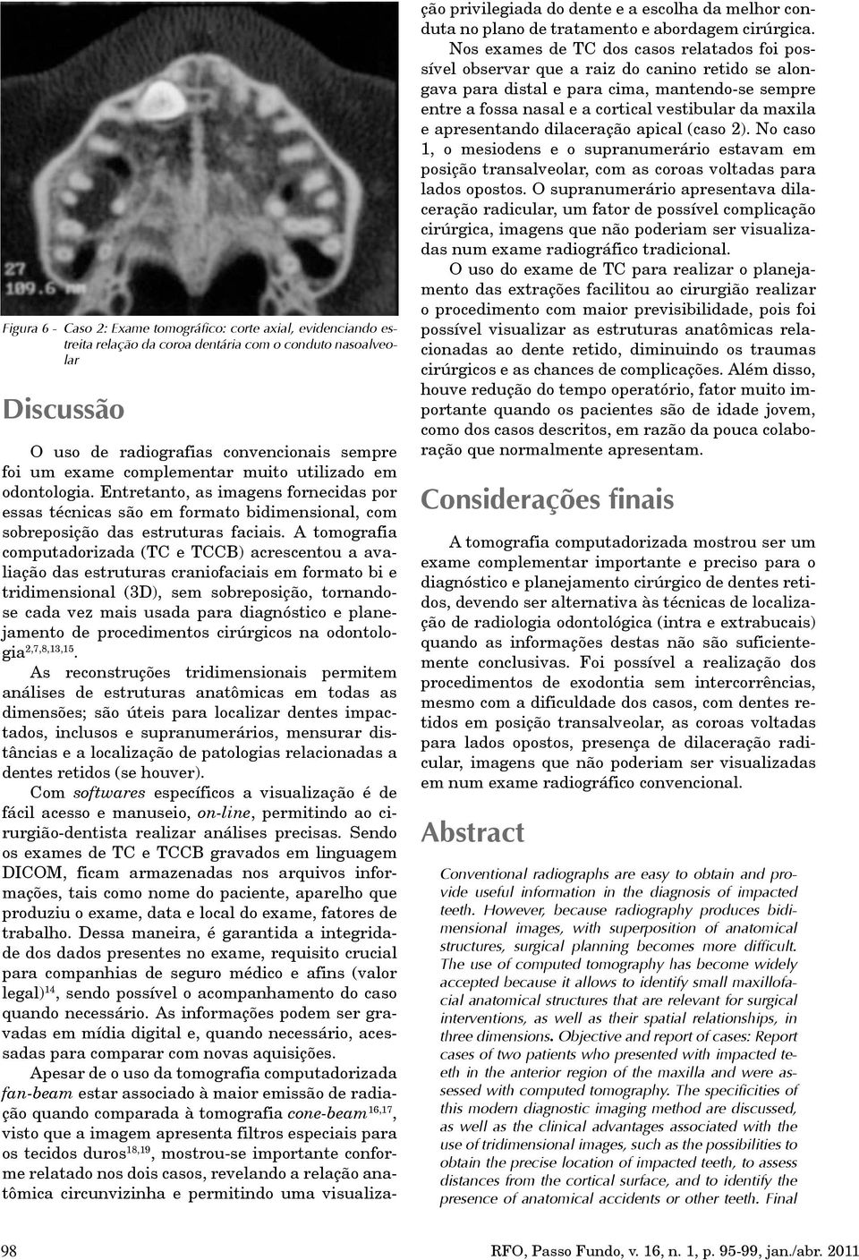 A tomografia computadorizada (TC e TCCB) acrescentou a avaliação das estruturas craniofaciais em formato bi e tridimensional (3D), sem sobreposição, tornandose cada vez mais usada para diagnóstico e