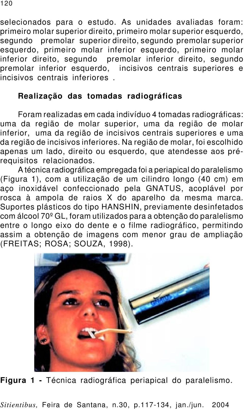 esquerdo, primeiro molar inferior direito, segundo premolar inferior direito, segundo premolar inferior esquerdo, incisivos centrais superiores e incisivos centrais inferiores.